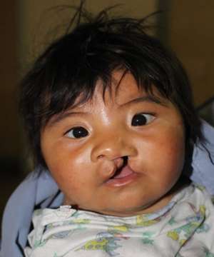 child pre-surgery