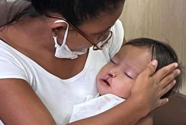 mother holding her child post-surgery
